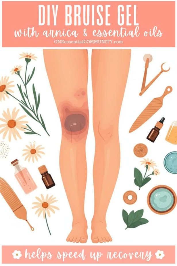DIY Bruise Gel with arnica & essential oils by oneessentialcommunity.com - helps speed up recovery. drawing of legs with bruise on the knee surrounded by ingredients that naturally help speed bruise healing like essential oil