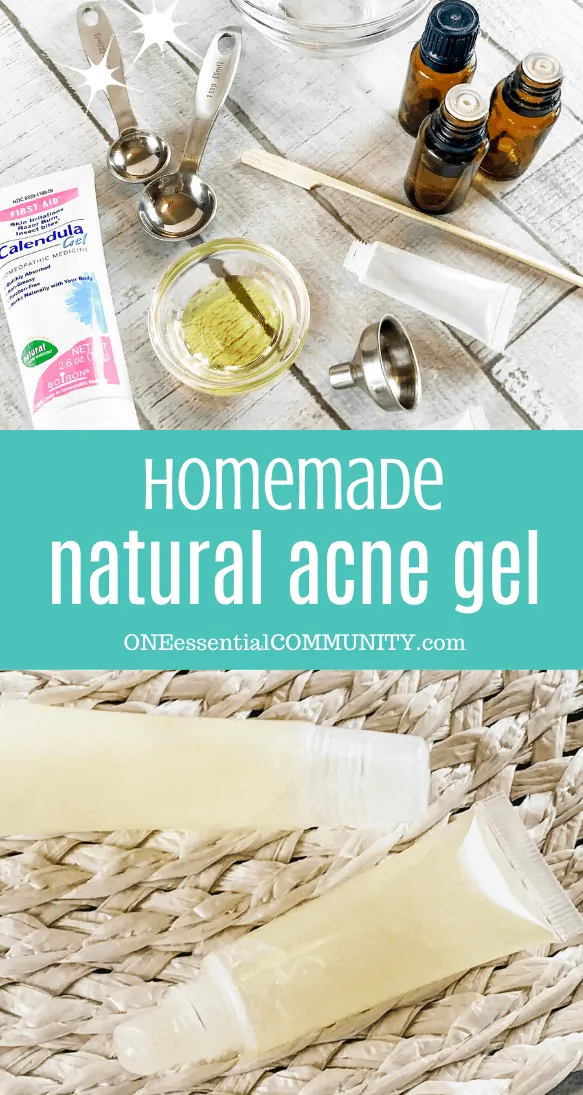 Homemade natural acne gel with essential oils treat pimples clear skin with this easy DIY acne treatment using essential oils